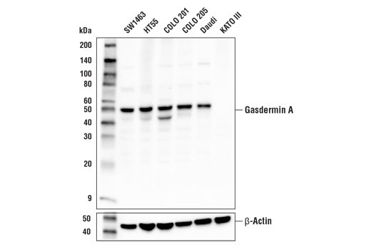 undefined Image 5: Gasdermin Family Antibody Sampler Kit