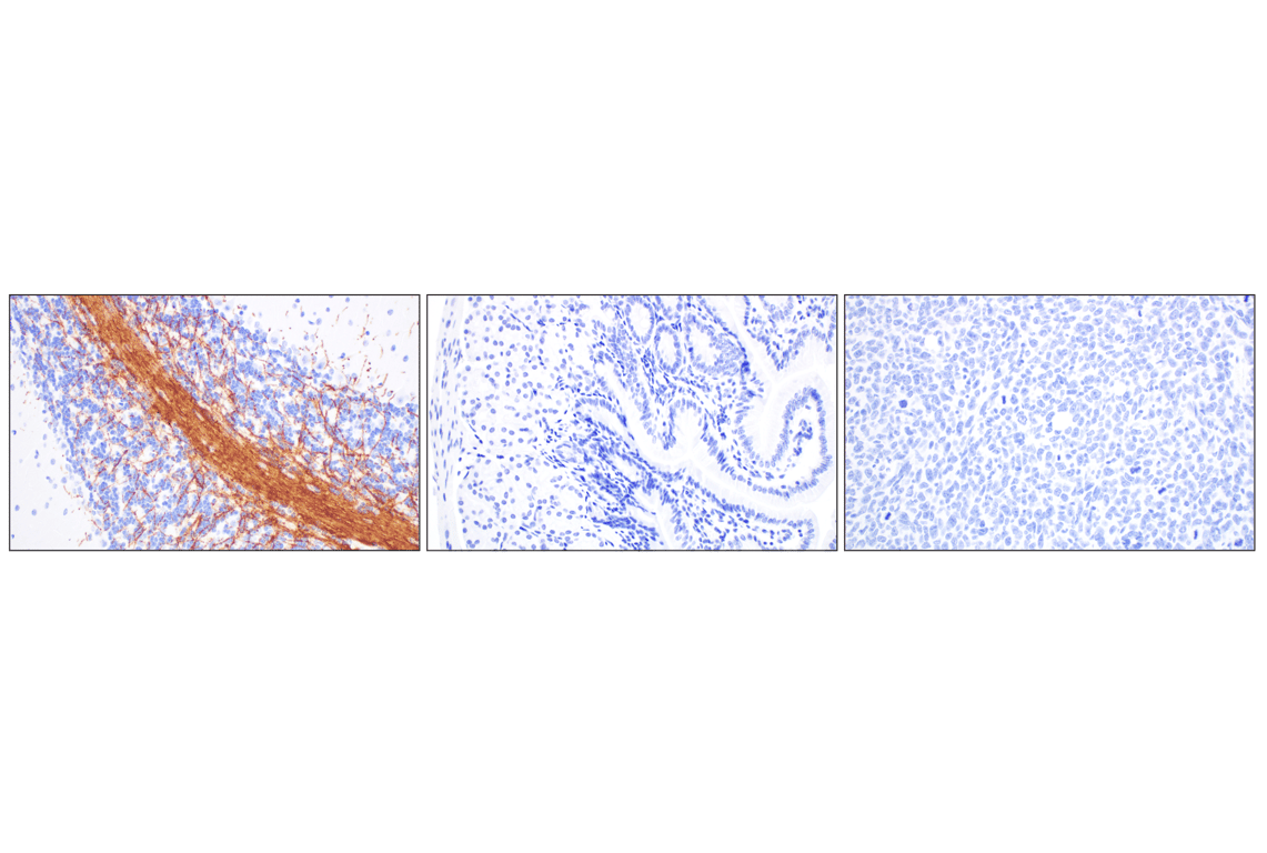 Immunohistochemistry Image 5: PLP1 (E9V1N) Rabbit Monoclonal Antibody (BSA and Azide Free)