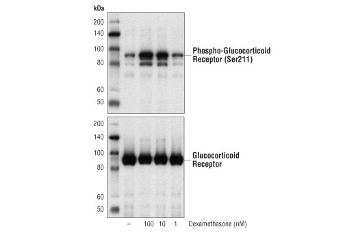 undefined Image 1: Dexamethasone