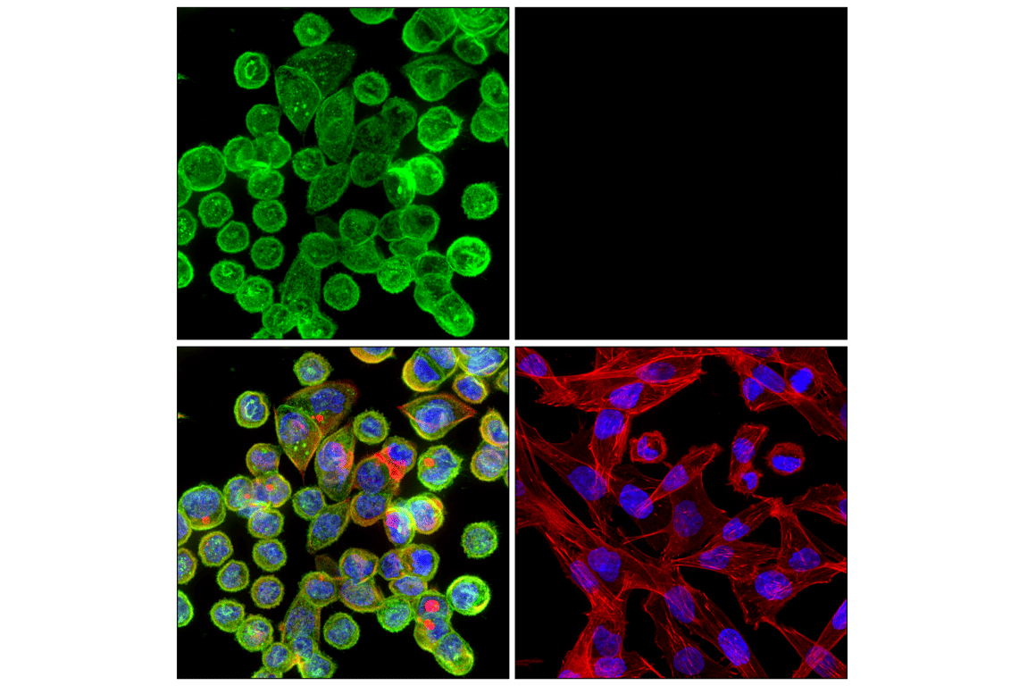 Immunofluorescence Image 1: FGF Receptor 2 (F3N9K) Rabbit Monoclonal Antibody
