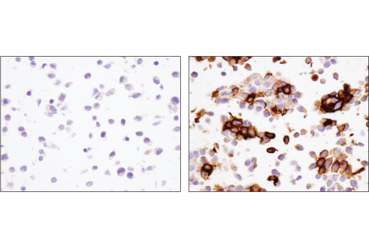 Immunohistochemistry Image 3: PD-1 (Intracellular Domain) (D4W2J) Rabbit Monoclonal Antibody