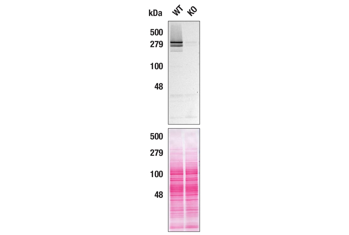 Western Blotting Image 2: Huntingtin (D7F7) Rabbit Monoclonal Antibody