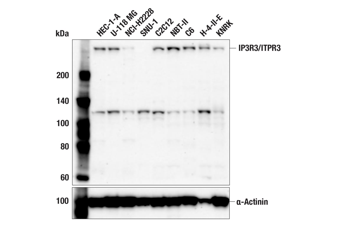 Western Blotting Image 2: IP3R3/ITPR3 (F3L2A) Rabbit Monoclonal Antibody
