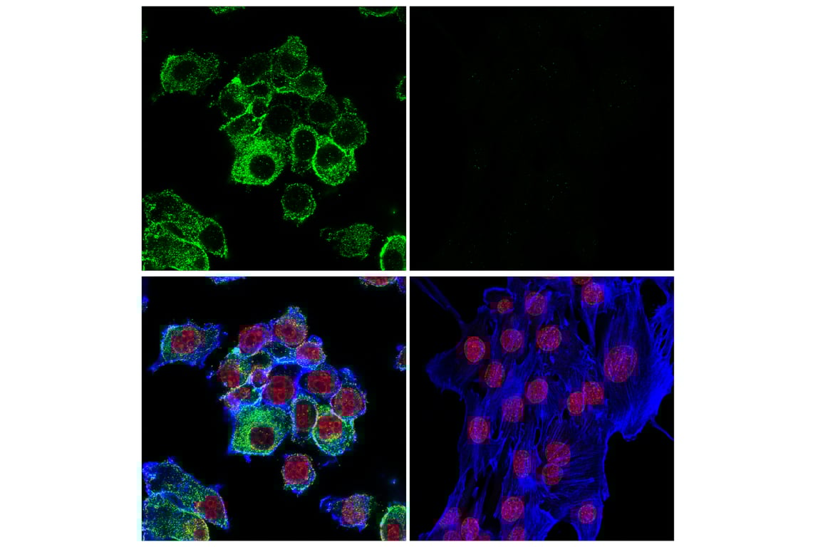 Immunofluorescence Image 1: CD11b/ITGAM (E6E1M) Rabbit Monoclonal Antibody