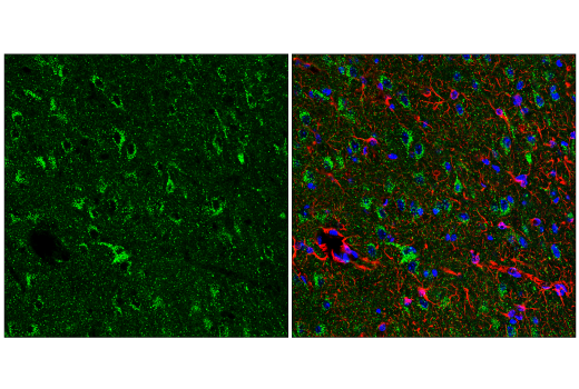 Immunofluorescence Image 1: EEA1 (E9Q6G) Mouse Monoclonal Antibody