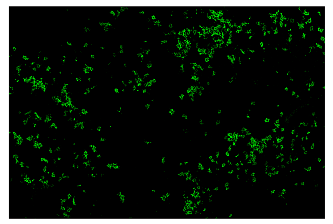 Immunohistochemistry Image 2: CD20 (E3N7O) & CO-0134-594 SignalStar<sup>™</sup> Oligo-Antibody Pair