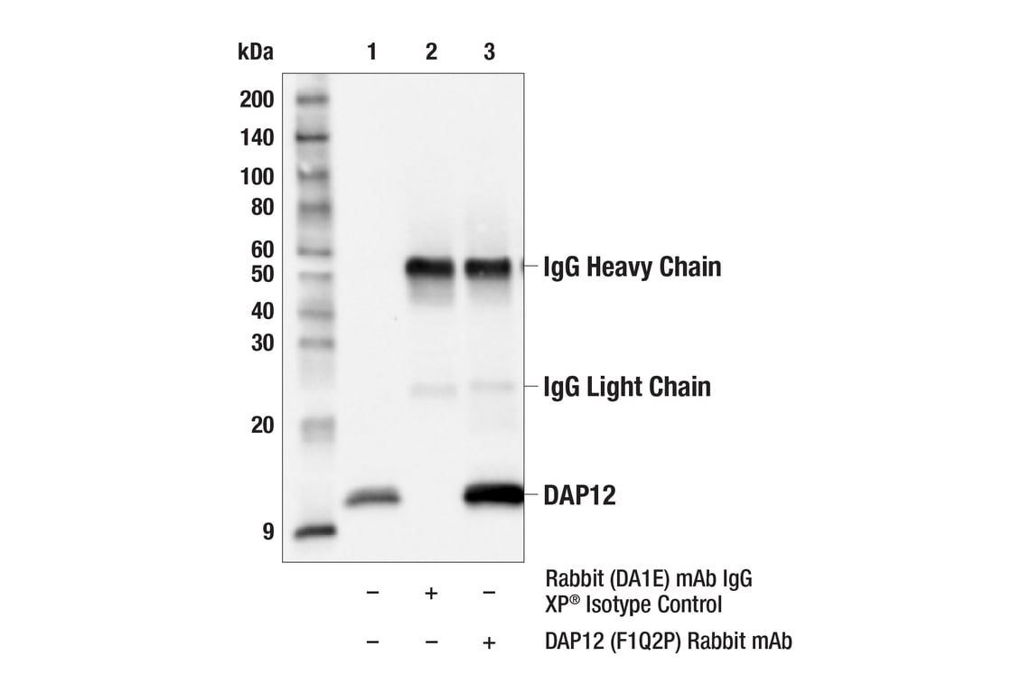 Immunoprecipitation Image 1: DAP12 (F1Q2P) Rabbit Monoclonal Antibody