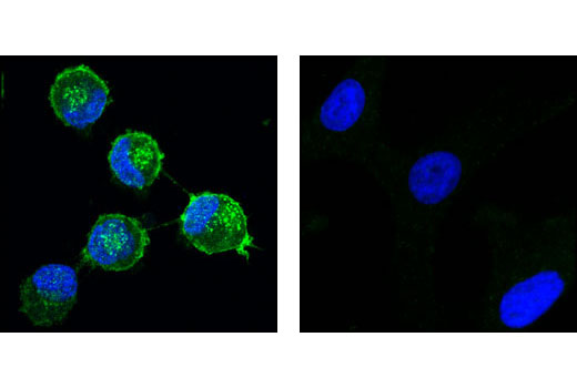 Immunofluorescence Image 1: PDGF Receptor alpha (D1E1E) Rabbit Monoclonal Antibody (BSA and Azide Free)