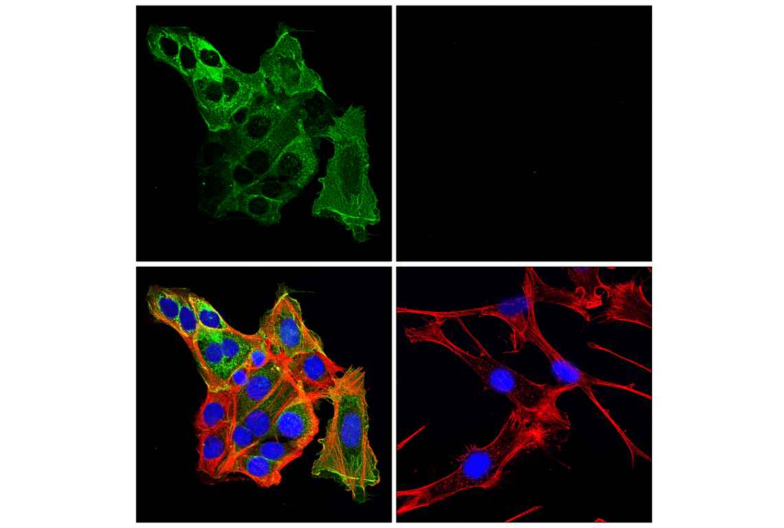 Immunofluorescence Image 1: CD10/Neprilysin (F4P6H) Rabbit Monoclonal Antibody (BSA and Azide Free)