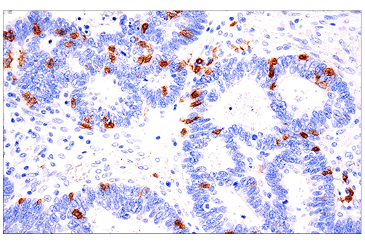 Immunohistochemistry Image 3: CD103/ITGAE (EP206) Rabbit Monoclonal Antibody