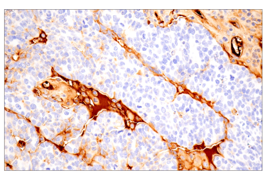 Immunohistochemistry Image 5: alpha-2-Macroglobulin (E6N7X) Rabbit Monoclonal Antibody