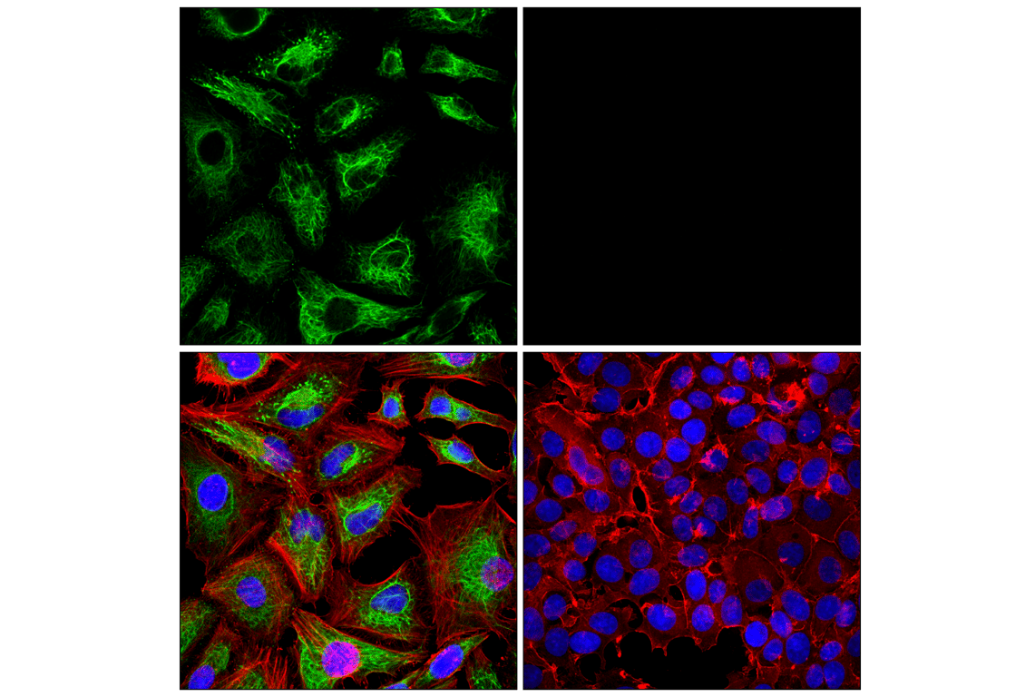 Immunofluorescence Image 1: Keratin 7 (RN7) Mouse Monoclonal Antibody