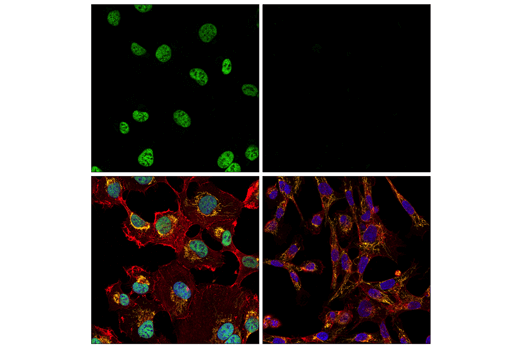 Immunofluorescence Image 1: ZEB1 (E2G6Y) Rabbit Monoclonal Antibody (BSA and Azide Free)