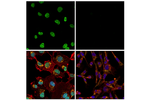 Immunofluorescence Image 1: ZEB1 (E2G6Y) XP<sup>®</sup> Rabbit mAb (BSA and Azide Free)