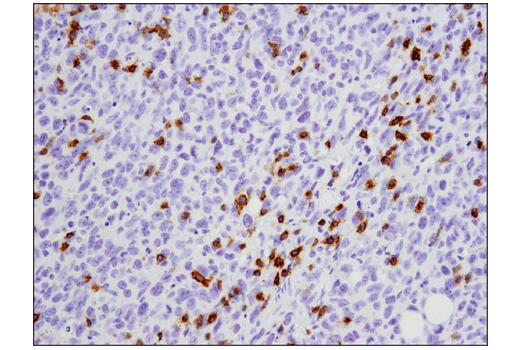 Immunohistochemistry Image 1: PD-1 (Intracellular Domain) (D7D5W) Rabbit Monoclonal Antibody