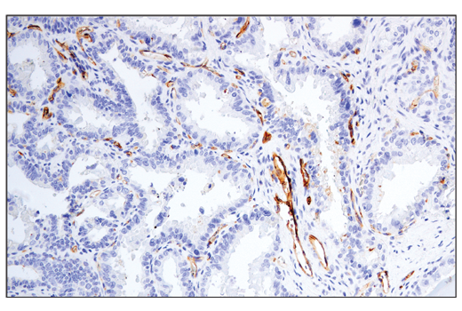 Immunohistochemistry Image 3: CD54/ICAM-1 (E3Q9N) XP<sup>®</sup> Rabbit mAb