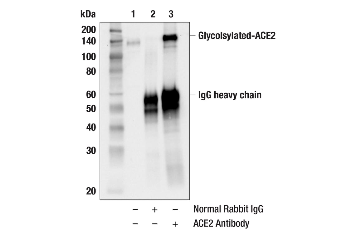 Immunoprecipitation Image 1: ACE2 Antibody