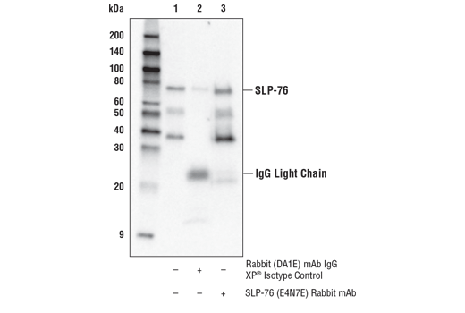 Immunoprecipitation Image 1: SLP-76 (E4N7E) Rabbit Monoclonal Antibody