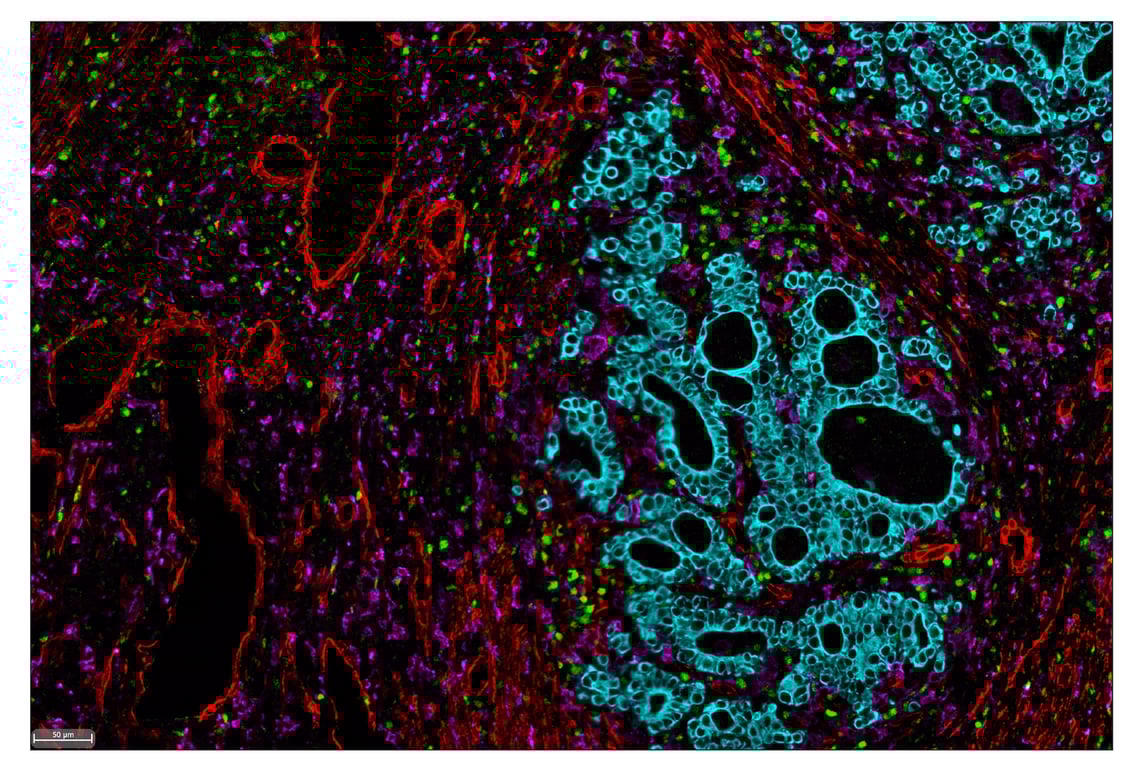 Immunohistochemistry Image 7: Tox/Tox2 (E6I3Q) & CO-0016-647 SignalStar<sup>™</sup> Oligo-Antibody Pair