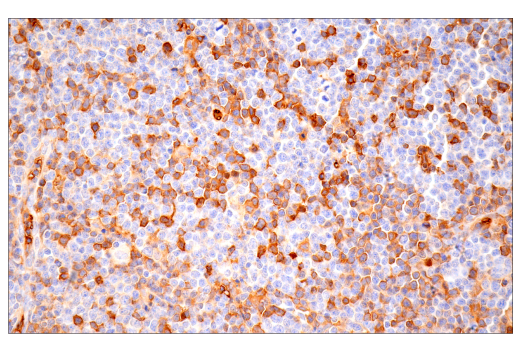 Immunohistochemistry Image 2: alpha-2-Macroglobulin (E6N7X) Rabbit Monoclonal Antibody