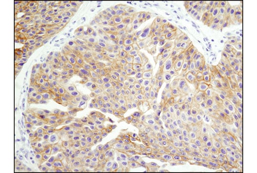 Immunohistochemistry Image 2: HER3/ErbB3 (D22C5) Rabbit Monoclonal Antibody (BSA and Azide Free)