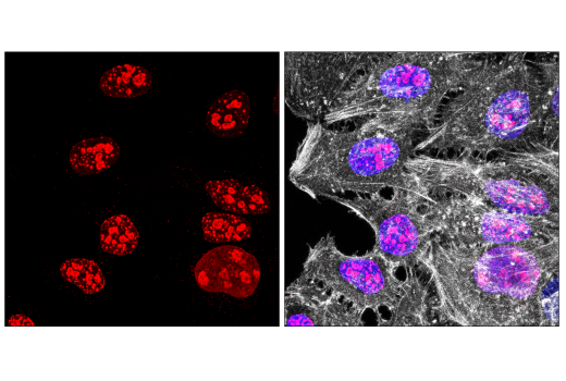 Immunofluorescence Image 1: Ki-67 (D3B5) Rabbit Monoclonal Antibody (Alexa Fluor<sup>®</sup> 594 Conjugate)