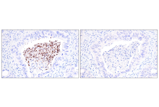 undefined Image 36: NETosis Antibody Sampler Kit