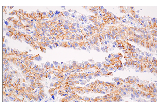 Immunohistochemistry Image 5: beta-Catenin (15B8) Mouse Monoclonal Antibody