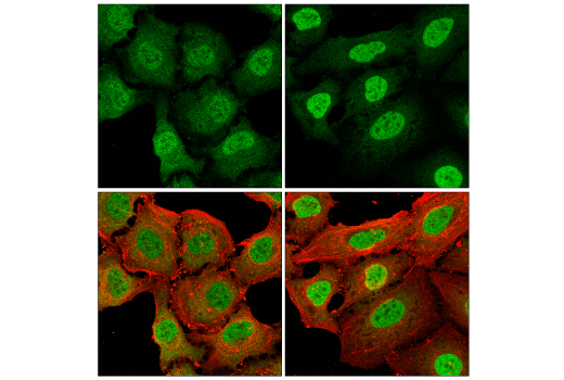 Immunofluorescence Image 1: Stat1 (D4Y6Z) Rabbit Monoclonal Antibody (BSA and Azide Free)