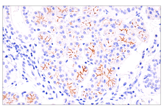Immunohistochemistry Image 2: DOG1/Anoctamin 1 (K9) Mouse Monoclonal Antibody