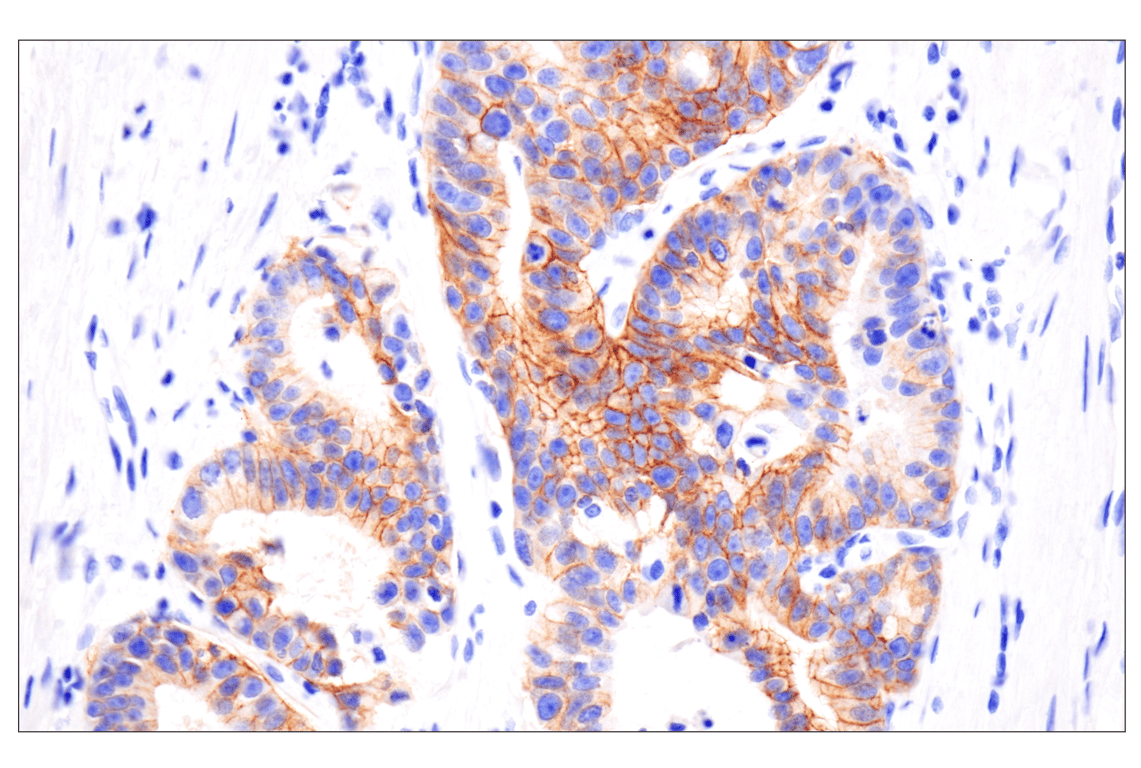 Immunohistochemistry Image 4: FGF Receptor 2 (D4L2V) Rabbit Monoclonal Antibody