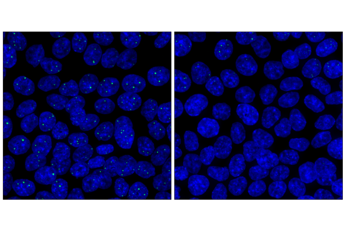 Immunofluorescence Image 1: NPAT (F1D9Q) Rabbit Monoclonal Antibody
