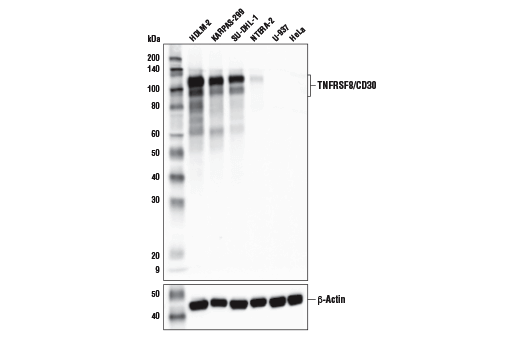 Western Blotting Image 2: TNFRSF8/CD30 (E7E4D) Rabbit Monoclonal Antibody (BSA and Azide Free)