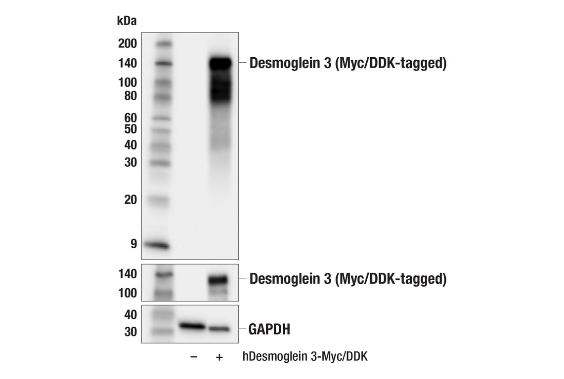 Western Blotting Image 2: Desmoglein 3 (5G11) Mouse Monoclonal Antibody
