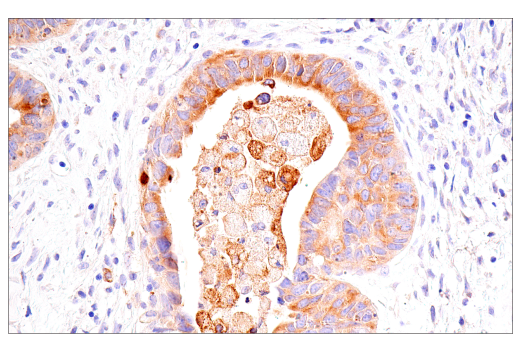 Immunohistochemistry Image 3: Transferrin Receptor/CD71 (10F11) Mouse Monoclonal Antibody
