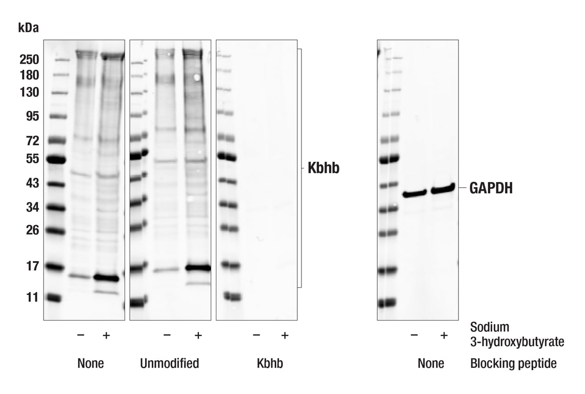Western Blotting Image 2: beta-Hydroxybutyryl Lysine (E6H5Q) Rabbit Monoclonal Antibody