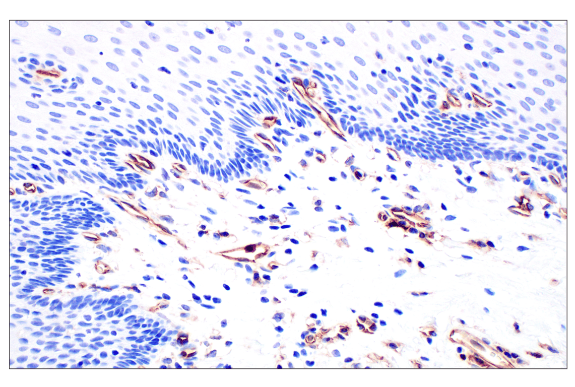 Immunohistochemistry Image 10: CD31 (PECAM-1) (F8M3S) Rabbit Monoclonal Antibody