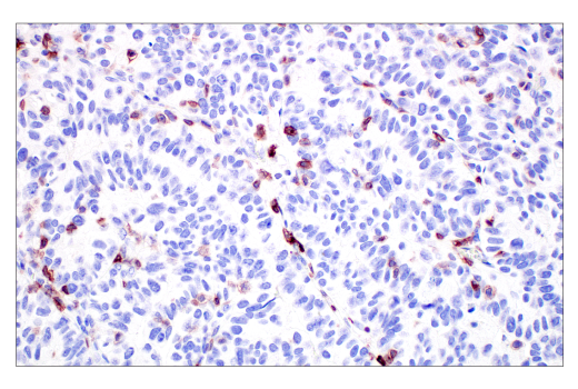 Immunohistochemistry Image 6: TIGIT (E5Y1W) Rabbit Monoclonal Antibody (BSA and Azide Free)