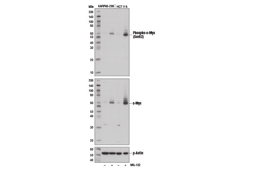 Western Blotting Image 2: Phospho-c-Myc (Ser62) (E1J4K) Rabbit Monoclonal Antibody