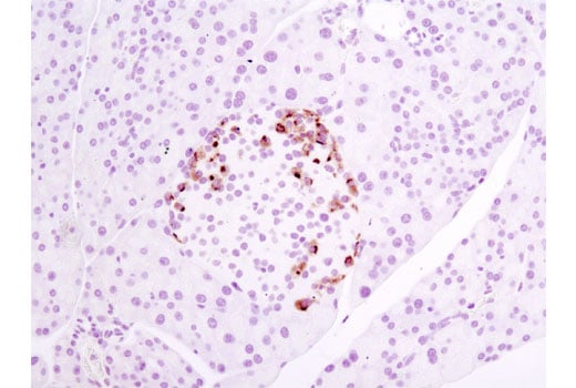 Immunohistochemistry Image 1: Neuropilin-2 (D39A5) Rabbit Monoclonal Antibody