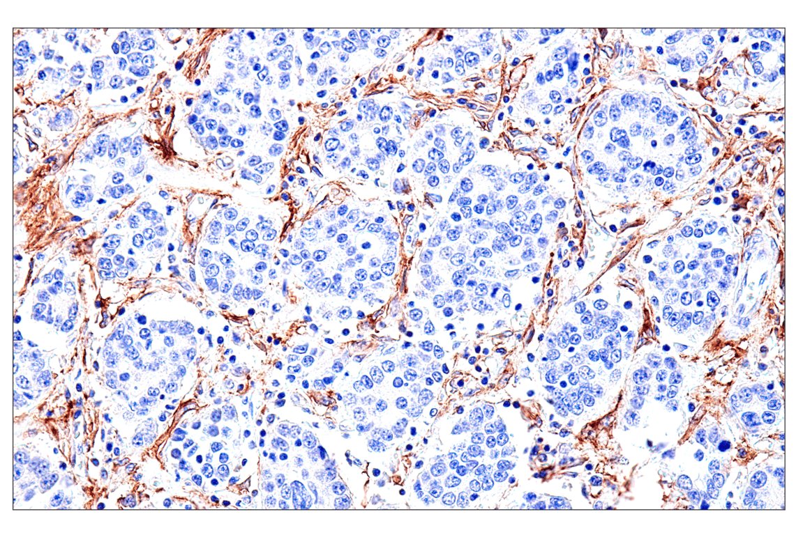Immunohistochemistry Image 10: FAP (F1A4G) Rabbit Monoclonal Antibody