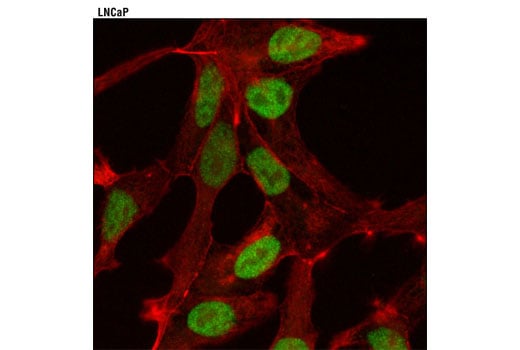 Immunofluorescence Image 1: JMJD2B (D7E6) Rabbit Monoclonal Antibody