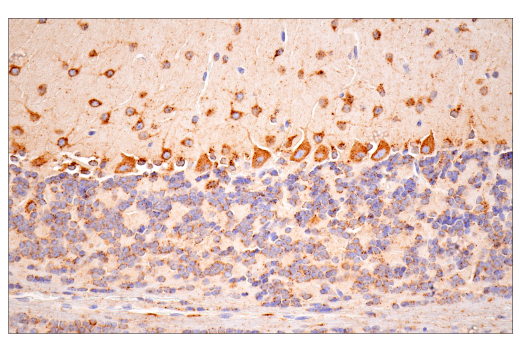 Immunohistochemistry Image 6: Cathepsin D (E7Z4L) XP<sup>®</sup> Rabbit mAb (BSA and Azide Free)