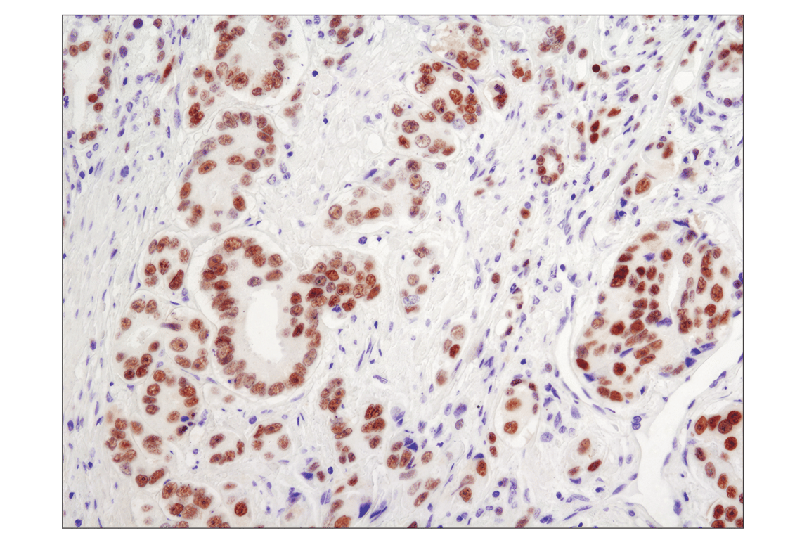 Immunohistochemistry Image 1: Androgen Receptor (D6F11) XP<sup>®</sup> Rabbit mAb (BSA and Azide Free)