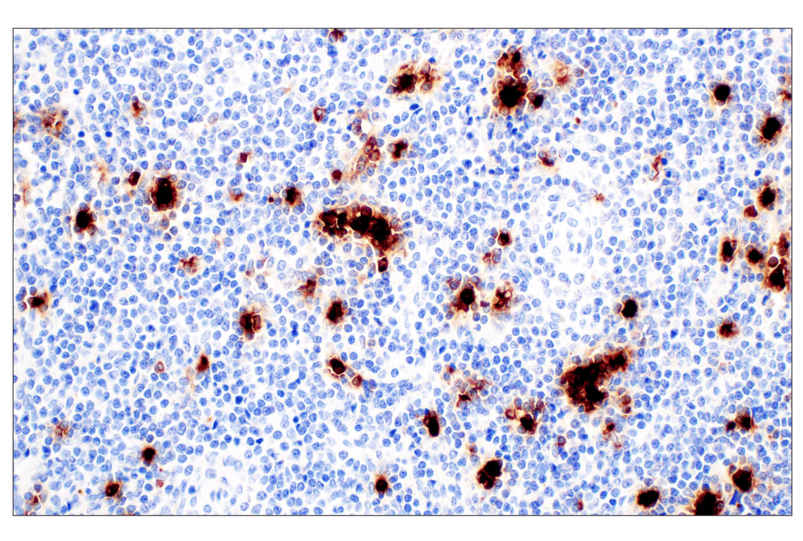 Immunohistochemistry Image 2: Neutrophil Elastase (F4H3X) Rabbit Monoclonal Antibody (BSA and Azide Free)