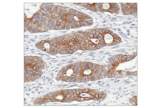 Immunohistochemistry Image 7: Pan-Keratin (C11) Mouse Monoclonal Antibody (BSA and Azide Free)
