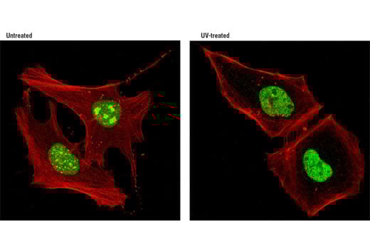 Immunofluorescence Image 1: Rad18 (D2B8) Rabbit Monoclonal Antibody
