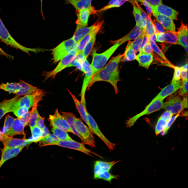 NDG Therapeutics Discovery