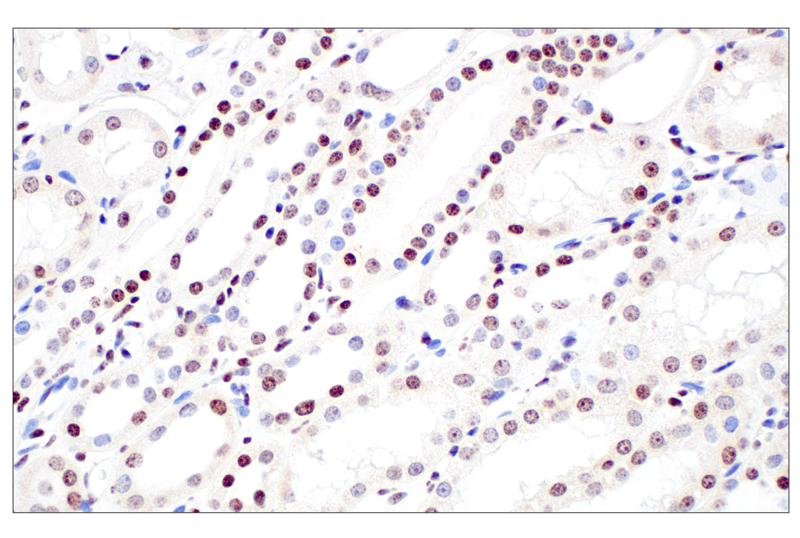 Immunohistochemistry Image 4: Tri-Methyl-Histone H3 (Lys27) (C36B11) Rabbit Monoclonal Antibody