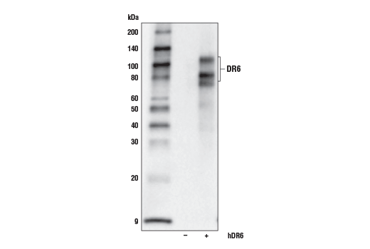 Western Blotting Image 2: DR6 (E8D2I) Rabbit Monoclonal Antibody